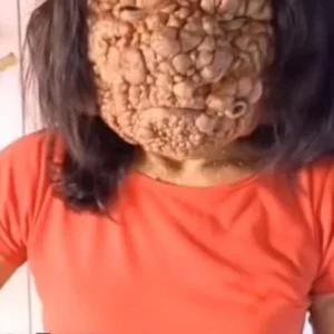 ¿Qué causa esto? ¿Qué causa esto?